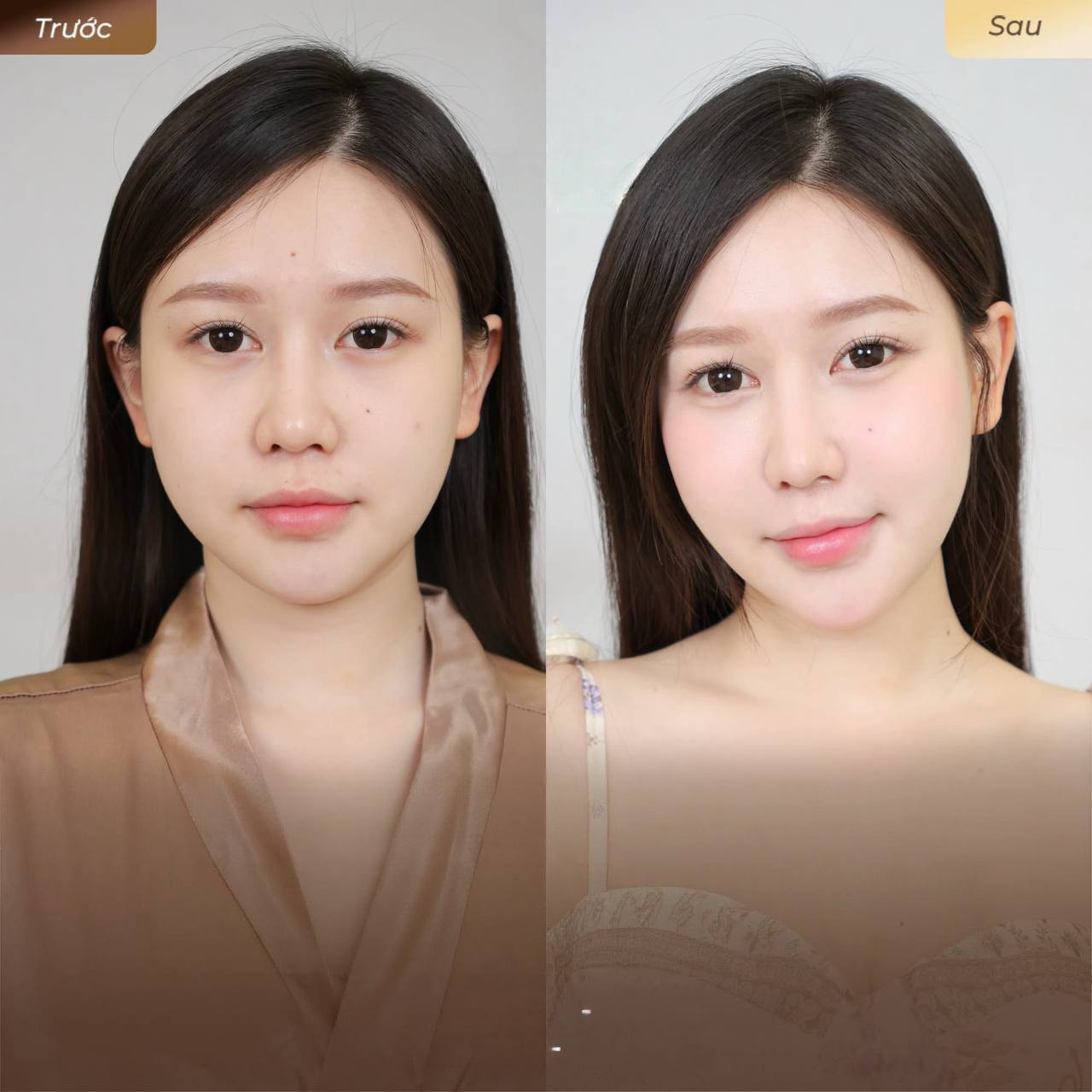 SPA THẨM MỸ
